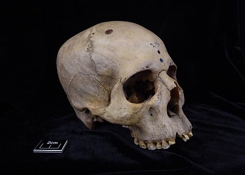 Skull 236 used in study