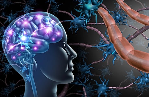 multiple sclerosis MS