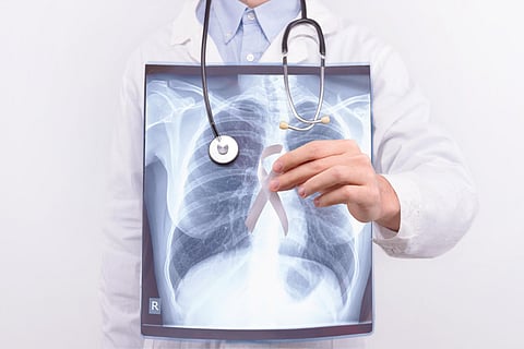 lung cancer screen