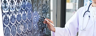 female doctor explaining brain scan images