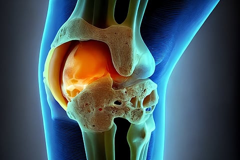 rodilla