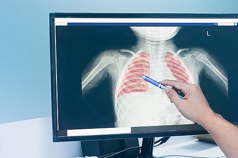child lungs