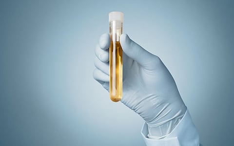 urine sample test urinary