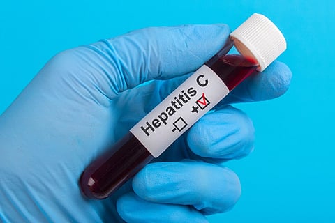 hepatitis C blood test