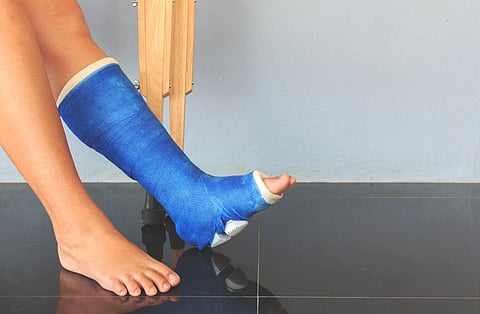 leg fracture