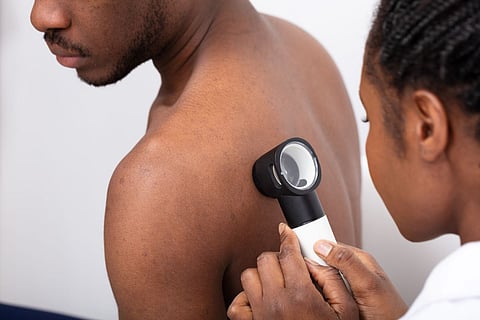 black skin exam