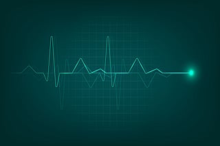 EKG electrocardiogram heartbeat results