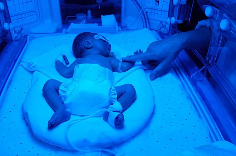 phototherapy newborn jaundice