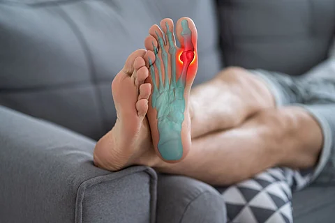 gout joint pain