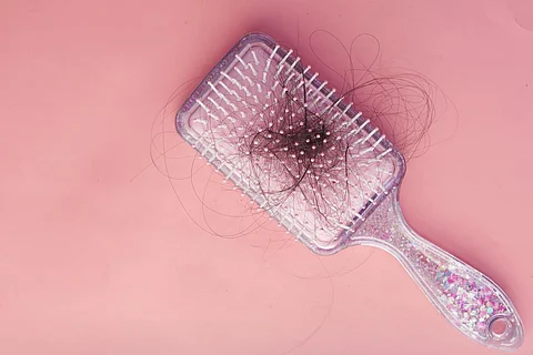 hair brush alopecia