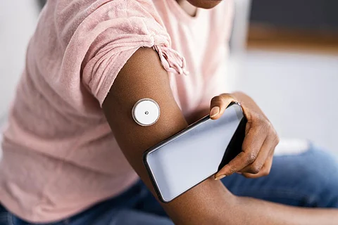 Mujer que prueba el nivel de glucosa con un monitor continuo de glucosa en el teléfono móvil