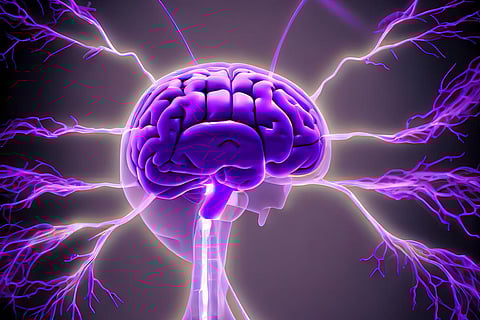 Cerebro Neurología epilepsia Alzheimer Parkinson