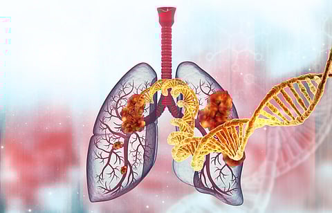 Human lung cancer with dna strand. 3d illustration