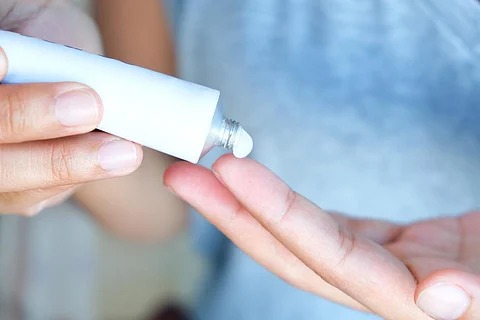 cream dermatitis skin eczema