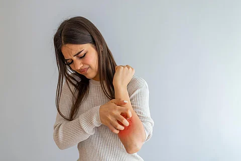 Woman Scratching an itch on white background . Sensitive Skin, Food allergy symptoms, Irritation. People scratch the itch with hand, Arm, itching, Concept with Healthcare And Medicine.