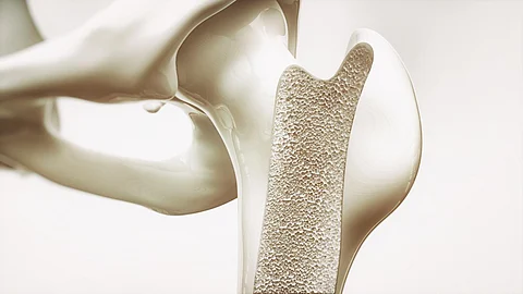 bone