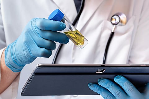 Physician holding test tube with urine sample for analysis in the biochemistry lab. Doctor holding a tablet and analyzing the results of the urinalysis