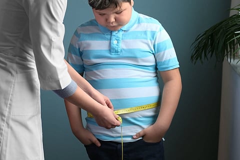 Niño obeso
