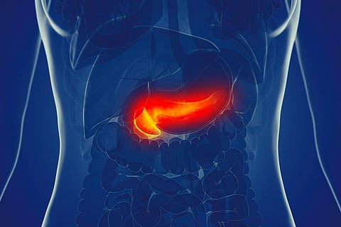 pancreas pancreatic pancreatitis