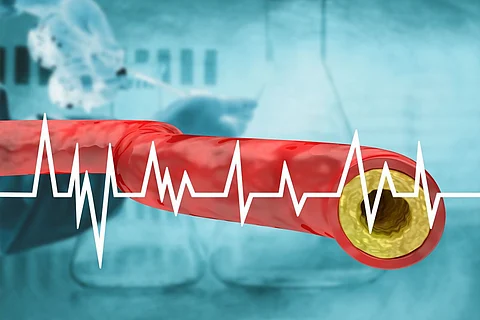 cholesterol