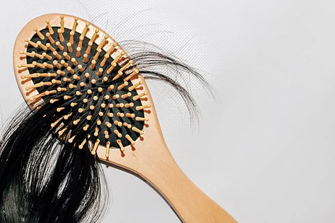 hair loss alopecia