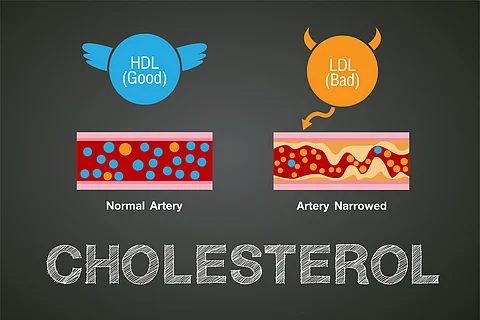 La combinación de dos medicamentos reduce el colesterol mejor que las estatinas solas