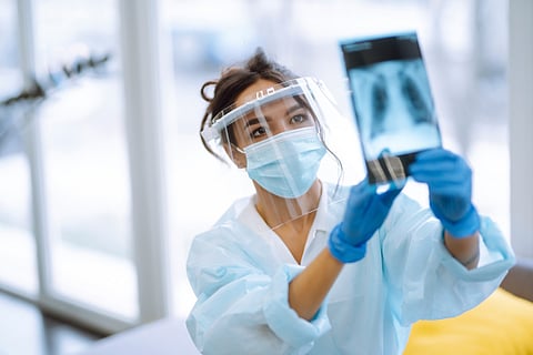 Los casos de tuberculosis pasan desapercibidos en las prisiones, lo que amenaza a las comunidades cercanas