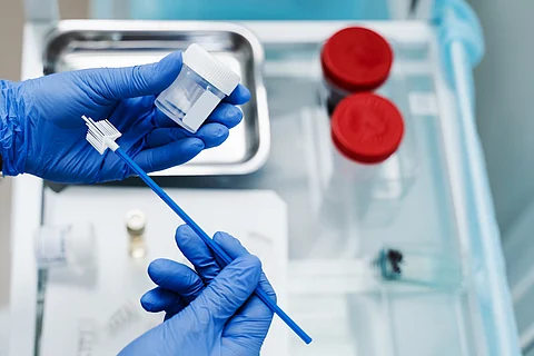 Citología ginecológica, Papanicolaou y citocepillo en manos del ginecólogo. El ginecólogo sostiene un frasco para la citología de la prueba de Papanicolaou en las manos.