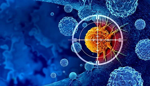 Detección y cribado del cáncer como tratamiento de las células malignas con una biopsia o pruebas causadas por carcinógenos y genética con una célula cancerosa como símbolo de inmunoterapia