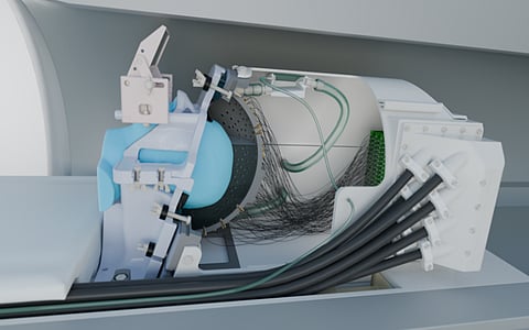 Investigadores de la UCL y la Universidad de Oxford han desarrollado un dispositivo de ultrasonido que puede estimular con precisión áreas profundas del cerebro sin cirugía, abriendo nuevas posibilidades para la investigación neurológica y el tratamiento de trastornos como la enfermedad de Parkinson.