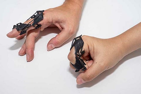 Un equipo del Laboratorio de Estructuras Interactivas desarrolló un aparato ortopédico totalmente personalizable que puede cambiar fácilmente de rígido a flexible con solo empujar o flexionar un dedo. También se puede imprimir en 3D y no requiere montaje.
