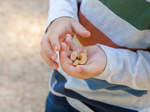 Mano de un niño sosteniendo cacahuetes, alergia al maní