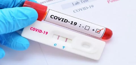 RT-PCR test mandatory for entering Maharashtra