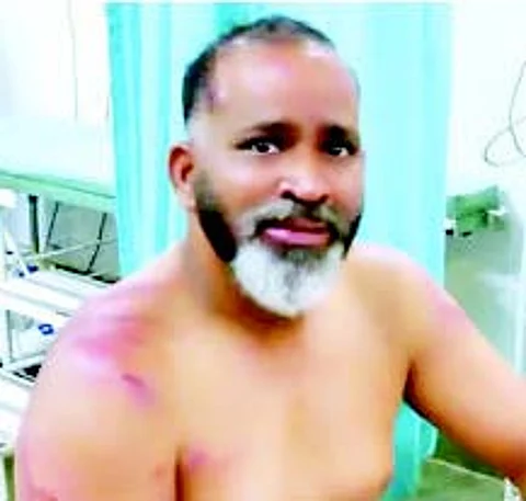 Six nabbed for attack on ex-sarpanch
