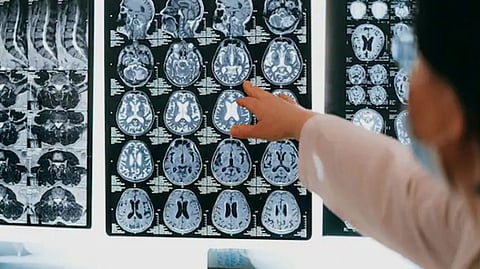 Kerala Reports 61 Brain-Eating Amoeba Cases, 19 Deaths; Health Alert Issued