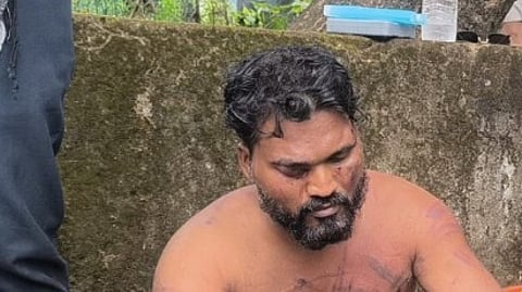 Social Activist Rama Kankonkar Brutally Attacked by Miscreants in Caranzalem
