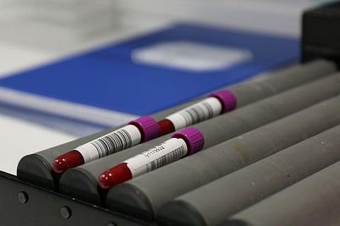 Hevosesta otetuista veri-, virtsa- tai muista näytteistä ei saa kilpailuhetkellä löytyä elimistöön kuulumattomia lääkeainejäämiä.