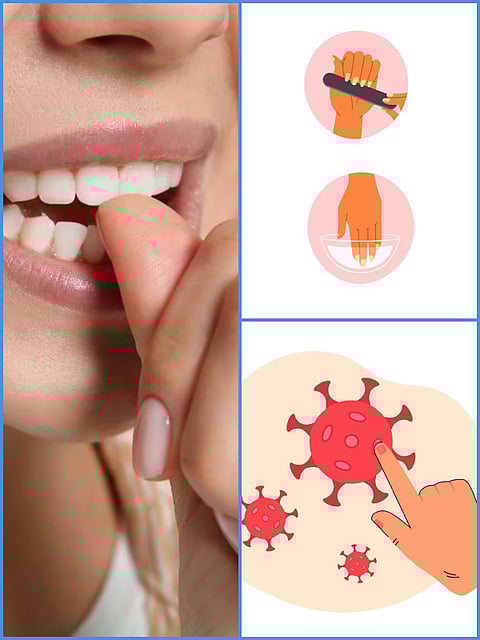 alert for nail biter