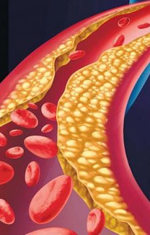 What are the Foods that Reduce Fat?