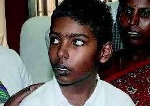 14 வயது சிறுவனுக்கு அரிதான இருதய அறுவைச் சிகிச்சை: அரசு மருத்துவமனை சாதனை