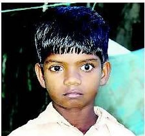 கண்ணை இழந்த மகனுக்காக கதறித் துடிக்கும் தாய்