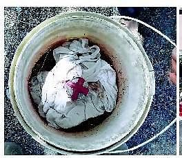 சிதம்பரத்தில் நாட்டுகுண்டு வெடித்து ஒருவர் படுகாயம்