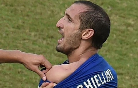 இத்தாலி வீரரை தோள்பட்டையில் கடித்துக் குதறிய உருகுவேயின் சுவாரேஸ்