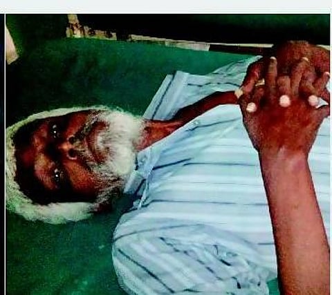 பேய் ஓட்டுவதாக முதியவர் தலையில் ஆணி அடித்த மந்திரவாதி: அரசு மருத்துவமனையில் வெற்றிகரமாக அகற்றம்