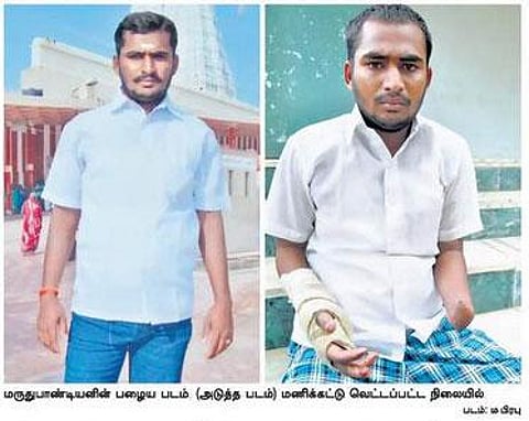 முதல்வரை சந்திக்க காத்திருக்கும் கை துண்டிக்கப்பட்ட இளைஞர்: அதிமுக மகளிர் அணி தலைவியின் மகனுக்கு நேர்ந்த விபரீதம்