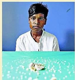 17 வயது சிறுவனின் வாயில் இருந்து 232 பற்கள் நீக்கம்: மும்பை மருத்துவர்கள் சாதனை