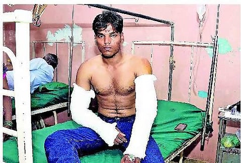 காலில் விழுந்து வணங்கச் சொல்லி பொறியியல் கல்லூரி மாணவரிடம் ராகிங்: உருட்டுக் கட்டையால் தாக்கியதால் கைகளில் எலும்பு முறிவு