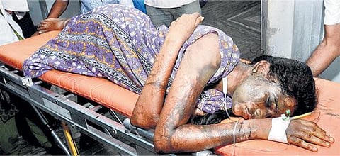 மதுரையில் மாணவிகள் மீது ஆசிட் வீசியது யார்?: போலீஸாரிடம் இன்னமும் சிக்காத குற்றவாளி