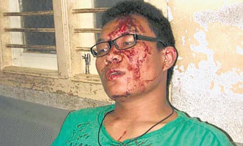 கன்னடத்தில் பேச வற்புறுத்தி மணிப்பூர் மாணவர்கள் மீது பெங்களூரில் தாக்குதல்