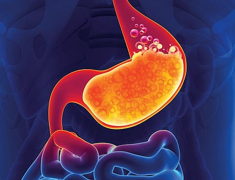 சாப்பிட்ட திருப்தியைப் பறிக்கும் புளித்த ஏப்பம்